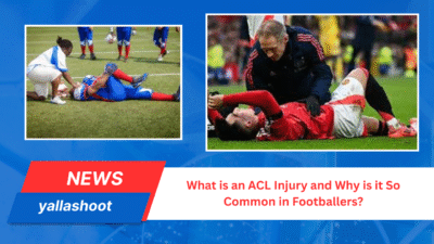 What is an ACL Injury and Why is it So Common in Footballers? 1 What is an ACL Injury